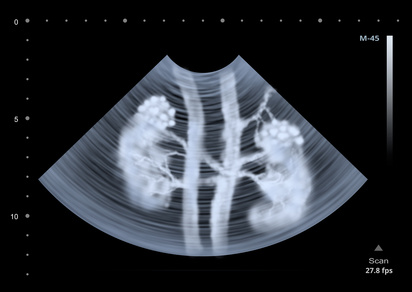 ecografia ultrasuoni