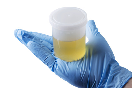 esame urine