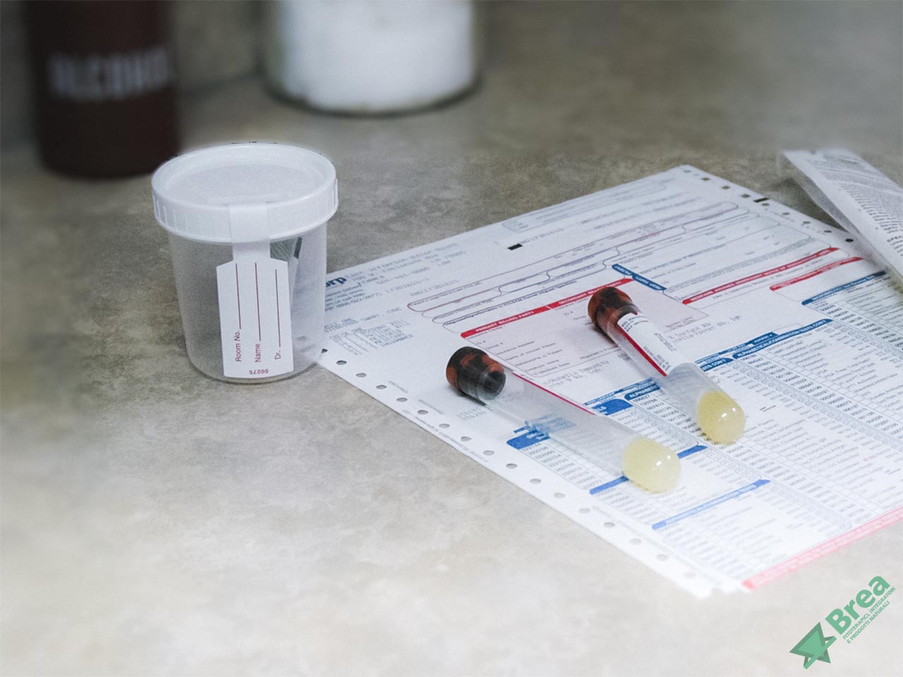 test urine